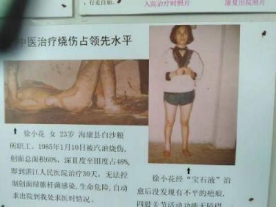 新时代国医名师—谢宝石