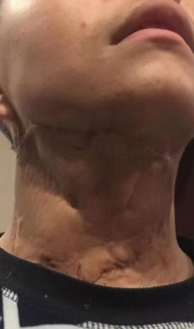 回归本源，让疤痕收回本该易防易治的本来形象！  去除疤痕——几千年做错了这一件事  排毒养疤——让疤痕还回了本容易康复的事情