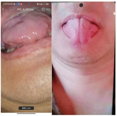 两会重点推荐  心令寿内经养生坊，破解渐冻症世界难题——白海军