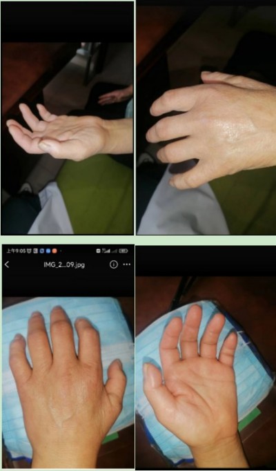 两会重点推荐  心令寿内经养生坊，破解渐冻症世界难题——白海军