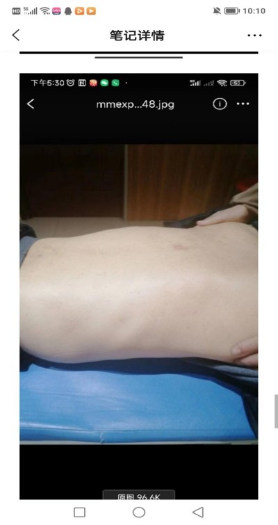 两会重点推荐  心令寿内经养生坊，破解渐冻症世界难题——白海军