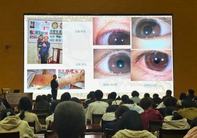 五一礼赞：徐秀明以虹膜之光，点亮全民健康新征程