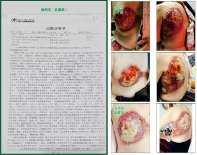 杨宗仙：中医传承创新领路人，为民治病写下传奇故事