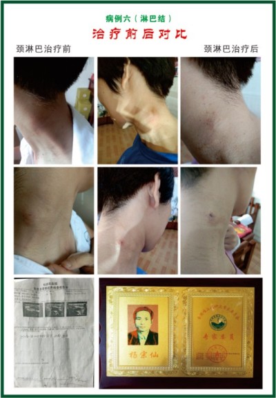 杨宗仙：中医传承创新领路人，为民治病写下传奇故事