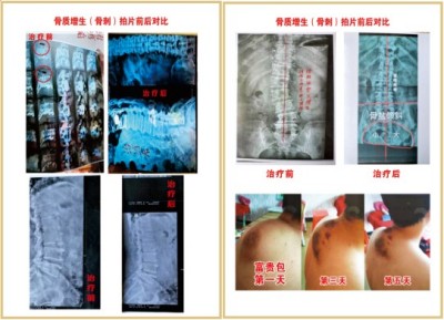 杨宗仙：中医传承创新领路人，为民治病写下传奇故事