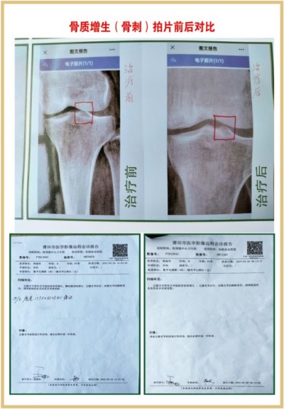 杨宗仙：中医传承创新领路人，为民治病写下传奇故事