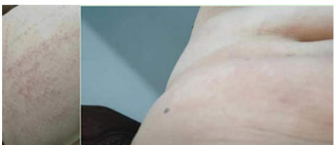 马年新春大拜年：承千年中医韵，暖万家健康情——访著名股骨头病专家严德华