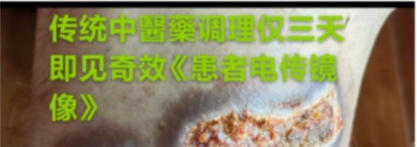 现代医疗手段与古代中医文化》 一一 疗效才是硬道理一一