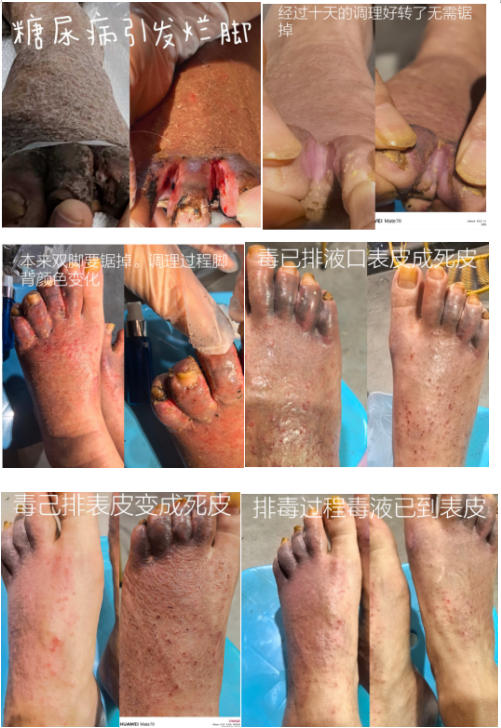 药食同源康养调理服务承诺书