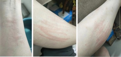 聚焦两会重点推荐 国医名师——王明保