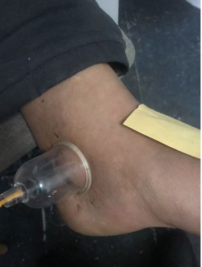 聚焦两会重点推荐 国医名师——王明保