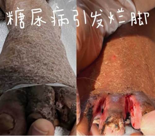 51特别报道：医路深耕五十载 仁心妙手守健康——记资深中医专家杨宗仙