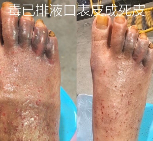 51特别报道：医路深耕五十载 仁心妙手守健康——记资深中医专家杨宗仙