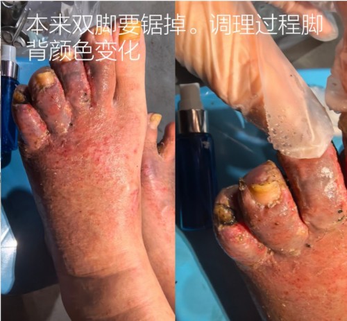 51特别报道：医路深耕五十载 仁心妙手守健康——记资深中医专家杨宗仙