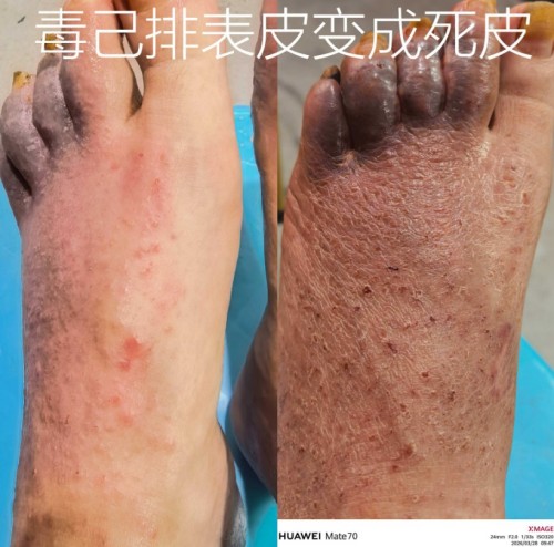 51特别报道：医路深耕五十载 仁心妙手守健康——记资深中医专家杨宗仙