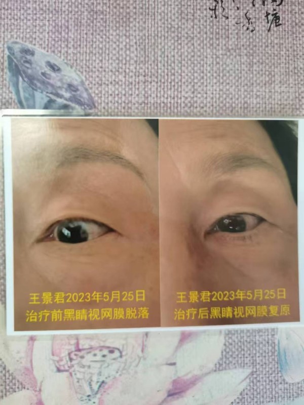 妙手仁心传古方，悬壶济世暖人间——记民间中医苏专荣