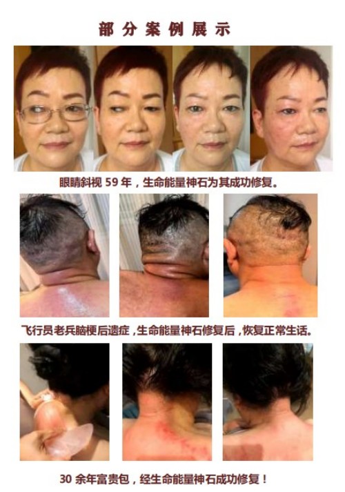 生命能量神石荣获国家科技成果奖，开启能量医学养生新征程