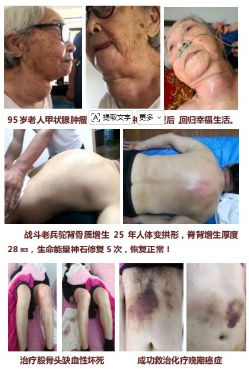 生命能量神石荣获国家科技成果奖，开启能量医学养生新征程