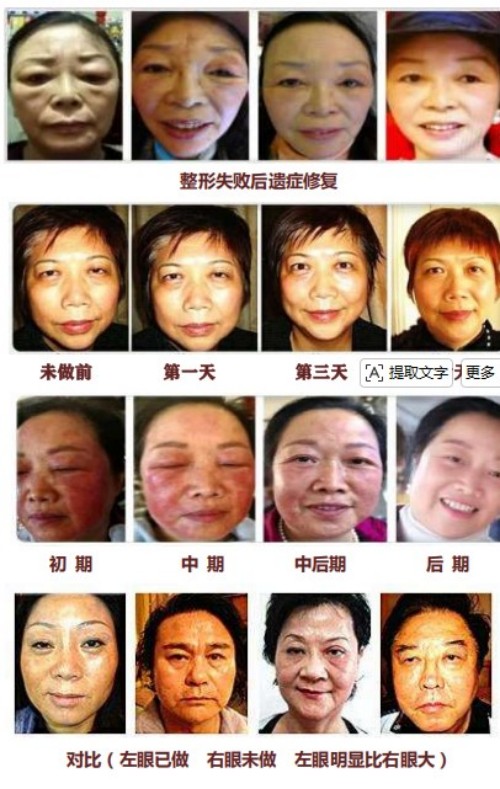生命能量神石荣获国家科技成果奖，开启能量医学养生新征程